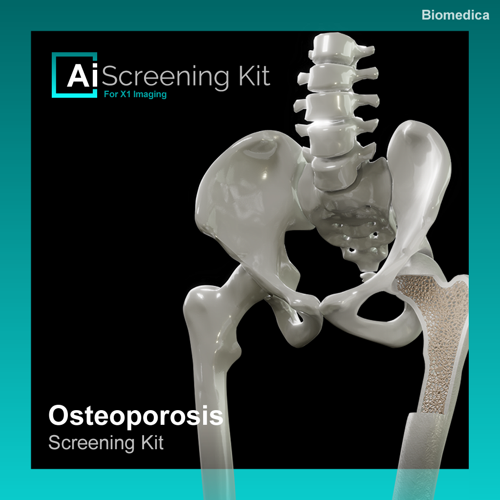 Osteoporosis Screening Kit